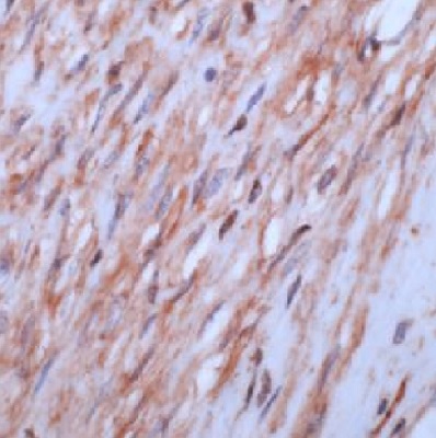Immunohistochemistry (Formalin/PFA-fixed paraffin-embedded sections) - Anti-beta Actin antibody - Cytoskeleton Marker (AB16039), expandable thumbnail