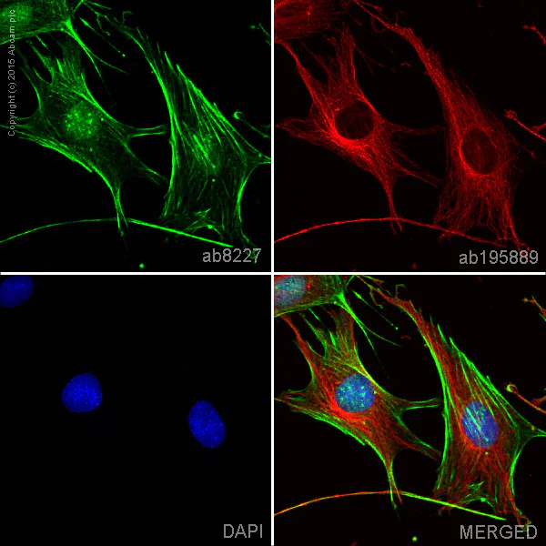 Immunocytochemistry/ Immunofluorescence - Anti-beta Actin antibody - Loading Control (AB8227)