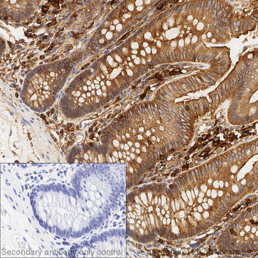 Immunohistochemistry (Formalin/PFA-fixed paraffin-embedded sections) - Anti-beta Actin antibody (ab8227), expandable thumbnail