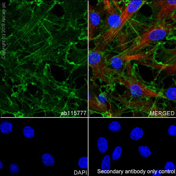 Immunocytochemistry/ Immunofluorescence - Anti-beta Actin antibody [SP124] - BSA and Azide free (AB242387)