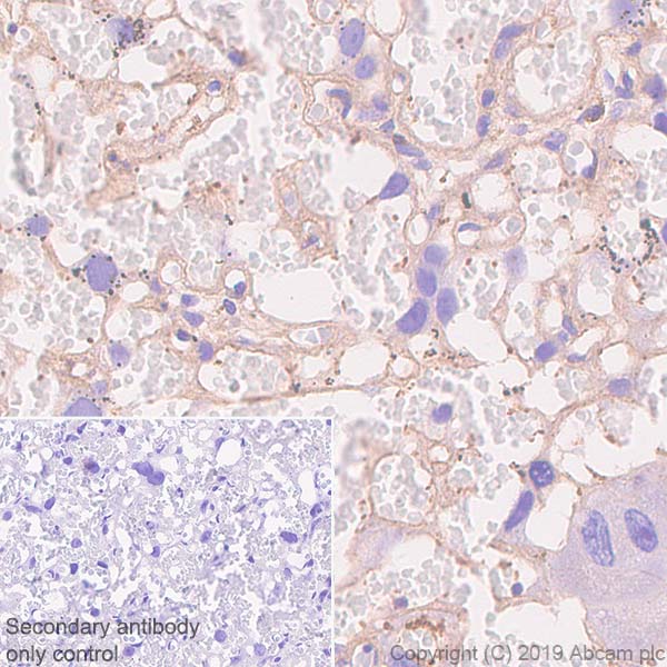 Immunohistochemistry (Formalin/PFA-fixed paraffin-embedded sections) - Anti-beta Actin antibody [SP124] - BSA and Azide free (AB242387), expandable thumbnail