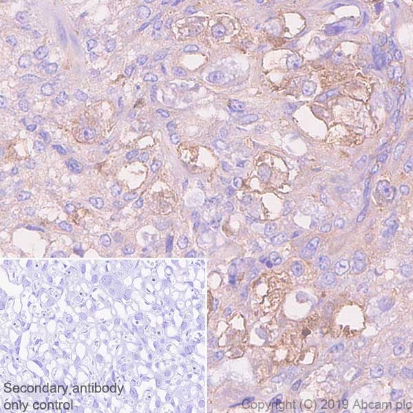 Immunohistochemistry (Formalin/PFA-fixed paraffin-embedded sections) - Anti-beta Actin antibody [SP124] - BSA and Azide free (AB242387), expandable thumbnail