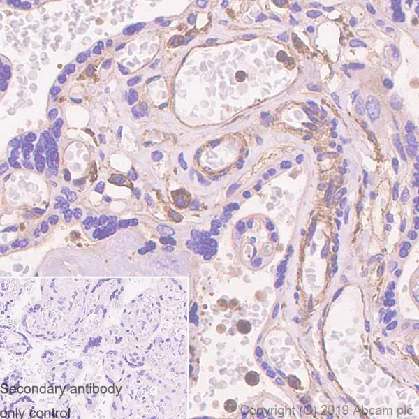 Immunohistochemistry (Formalin/PFA-fixed paraffin-embedded sections) - Anti-beta Actin antibody [SP124] - Cytoskeleton Marker (AB115777)