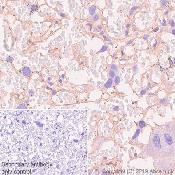 Immunohistochemistry (Formalin/PFA-fixed paraffin-embedded sections) - Anti-beta Actin antibody [SP124] - Cytoskeleton Marker (AB115777)