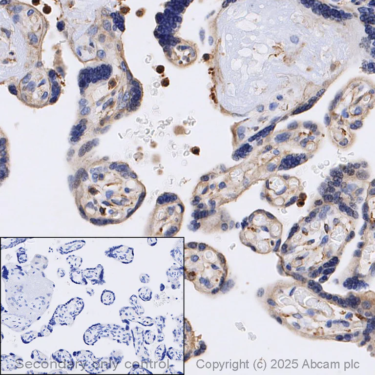 Immunohistochemistry (Formalin/PFA-fixed paraffin-embedded sections) - Anti-beta Actin antibody [SP124] - Cytoskeleton Marker (AB115777)