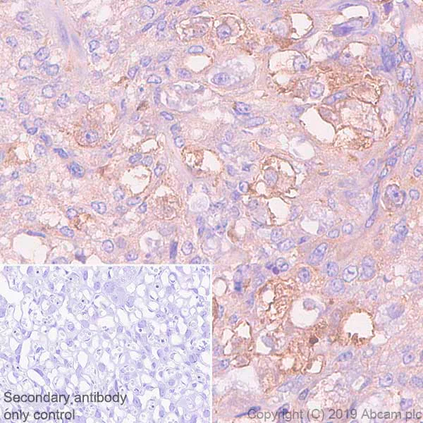 Immunohistochemistry (Formalin/PFA-fixed paraffin-embedded sections) - Anti-beta Actin antibody [SP124] - Cytoskeleton Marker (AB115777)