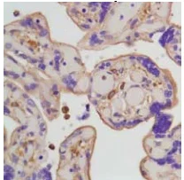 Immunohistochemistry (Formalin/PFA-fixed paraffin-embedded sections) - Anti-beta Actin antibody [SP124] - Cytoskeleton Marker (AB115777)