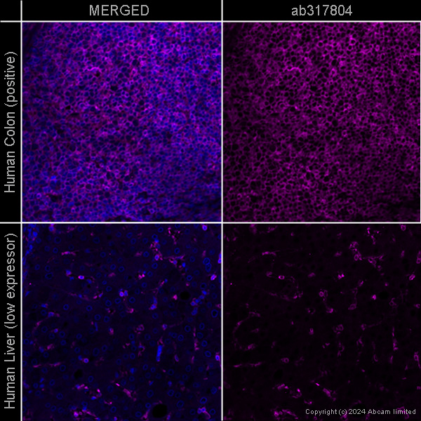 Immunohistochemistry (Formalin/PFA-fixed paraffin-embedded sections) - Anti-beta Actin antibody [SP124] - Cytoskeleton Marker – Goat IgG (Chimeric) (AB317794), expandable thumbnail