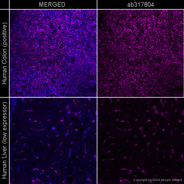 Immunohistochemistry (Formalin/PFA-fixed paraffin-embedded sections) - Anti-beta Actin antibody [SP124] - Cytoskeleton Marker – Goat IgG (Chimeric) (AB317794)