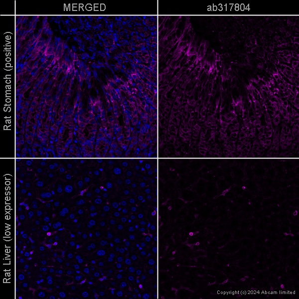 Immunohistochemistry (Formalin/PFA-fixed paraffin-embedded sections) - Anti-beta Actin antibody [SP124] - Cytoskeleton Marker – Goat IgG (Chimeric) (AB317794), expandable thumbnail