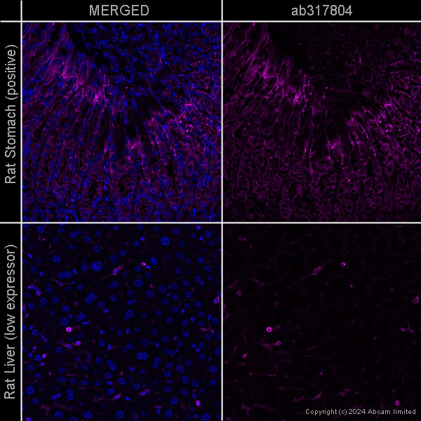 Immunohistochemistry (Formalin/PFA-fixed paraffin-embedded sections) - Anti-beta Actin antibody [SP124] - Cytoskeleton Marker – Goat IgG (Chimeric) (AB317794)