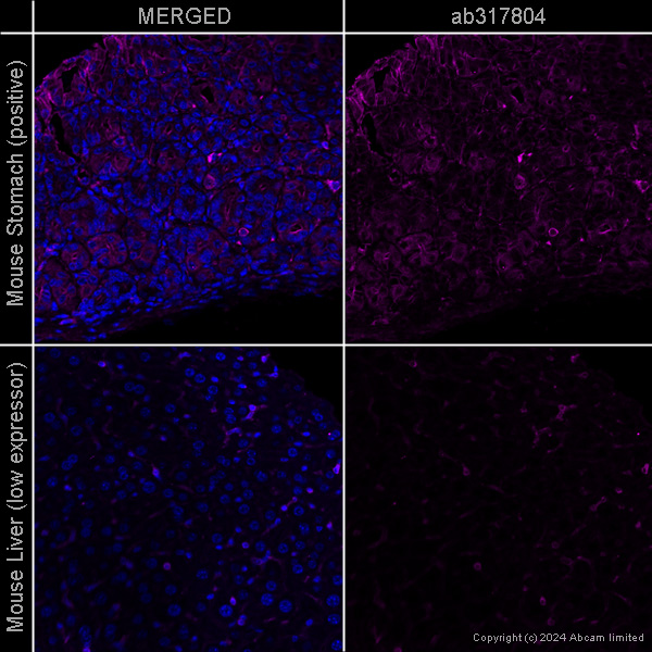 Immunohistochemistry (Formalin/PFA-fixed paraffin-embedded sections) - Anti-beta Actin antibody [SP124] - Cytoskeleton Marker – Goat IgG (Chimeric) (AB317794), expandable thumbnail