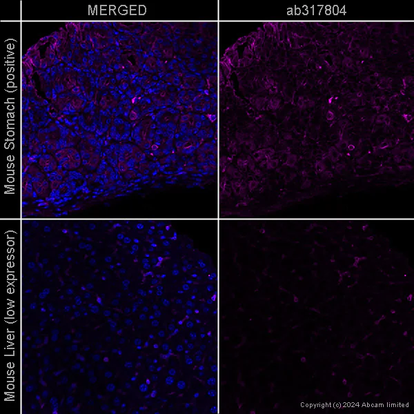 Immunohistochemistry (Formalin/PFA-fixed paraffin-embedded sections) - Anti-beta Actin antibody [SP124] - Cytoskeleton Marker – Goat IgG (Chimeric) (AB317794)