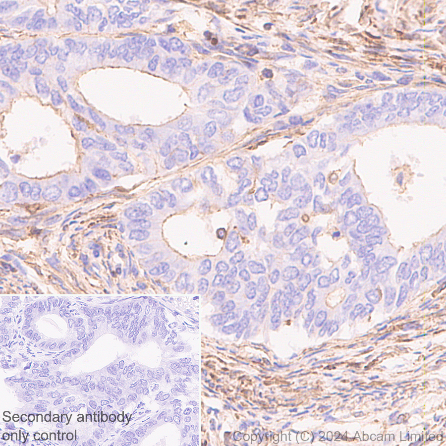 Immunohistochemistry (Formalin/PFA-fixed paraffin-embedded sections) - Anti-beta Actin (mono methyl H73) antibody [EPR29292-70] (ab322203), expandable thumbnail
