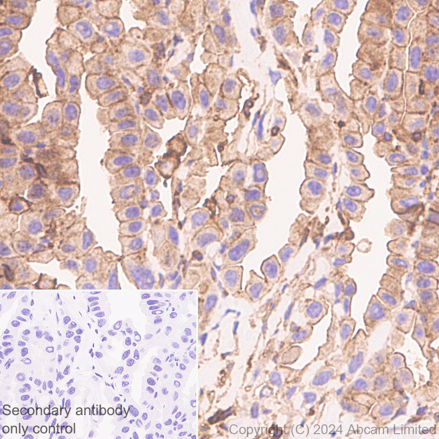 Immunohistochemistry (Formalin/PFA-fixed paraffin-embedded sections) - Anti-beta Actin (mono methyl H73) antibody [EPR29292-70] (ab322203), expandable thumbnail
