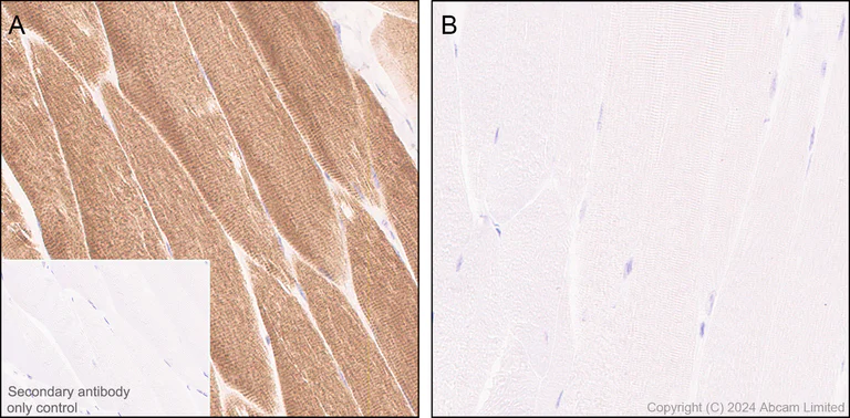 Immunohistochemistry (Formalin/PFA-fixed paraffin-embedded sections) - Anti-beta Actin (mono methyl H73) antibody [EPR29292-70] - BSA and Azide free (AB324775)