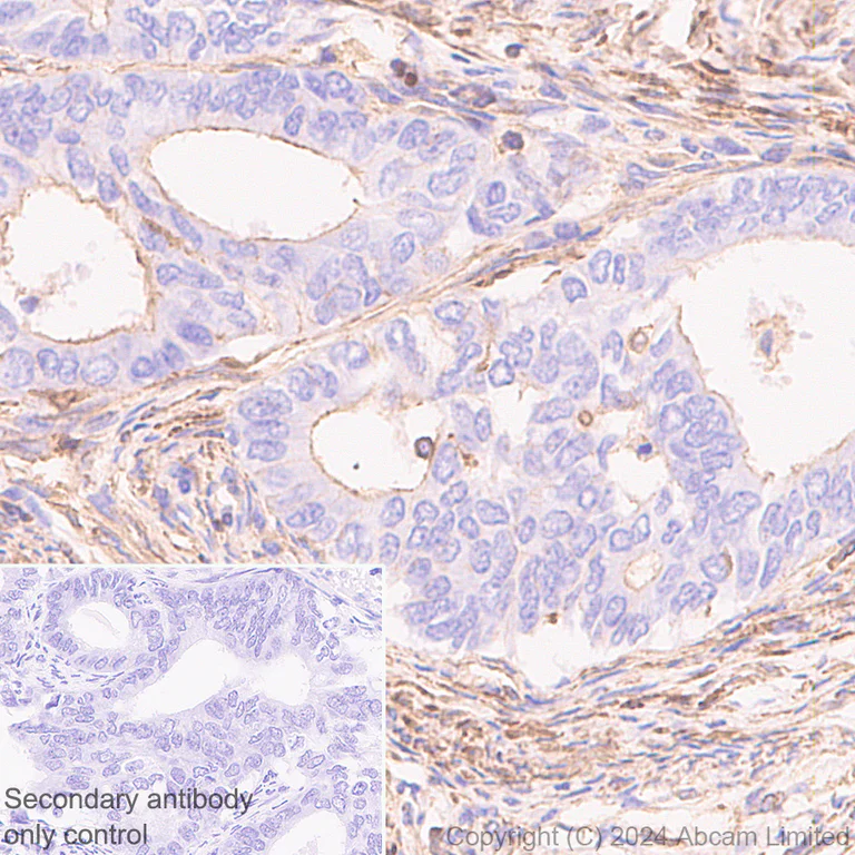 Immunohistochemistry (Formalin/PFA-fixed paraffin-embedded sections) - Anti-beta Actin (mono methyl H73) antibody [EPR29292-70] - BSA and Azide free (AB324775)