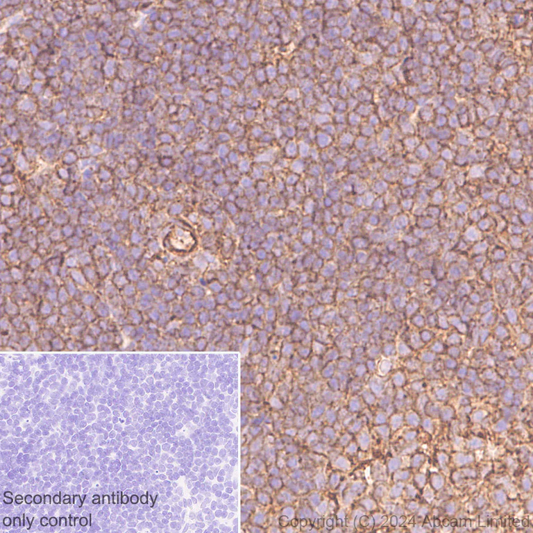 Immunohistochemistry (Formalin/PFA-fixed paraffin-embedded sections) - Anti-beta Actin (mono methyl H73) antibody [EPR29292-70] - BSA and Azide free (AB324775)