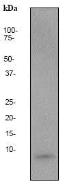 Western blot - Anti-beta Amyloid 1-40 antibody [EP1876Y] (AB76317)