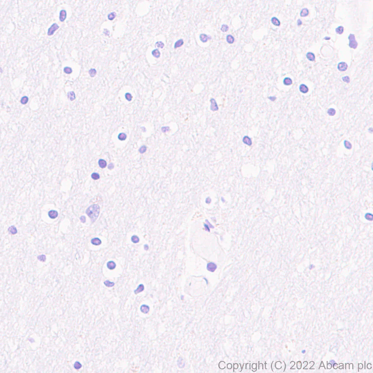 Immunohistochemistry (Formalin/PFA-fixed paraffin-embedded sections) - Anti-beta Amyloid 1-40 antibody [EPR23712-2] - BSA and Azide free (AB289991)