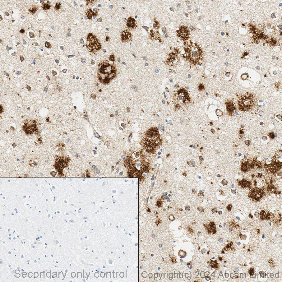 Immunohistochemistry (Formalin/PFA-fixed paraffin-embedded sections) - Anti-beta Amyloid 1-42 antibody [mOC64] - BSA and Azide free (AB271968), expandable thumbnail