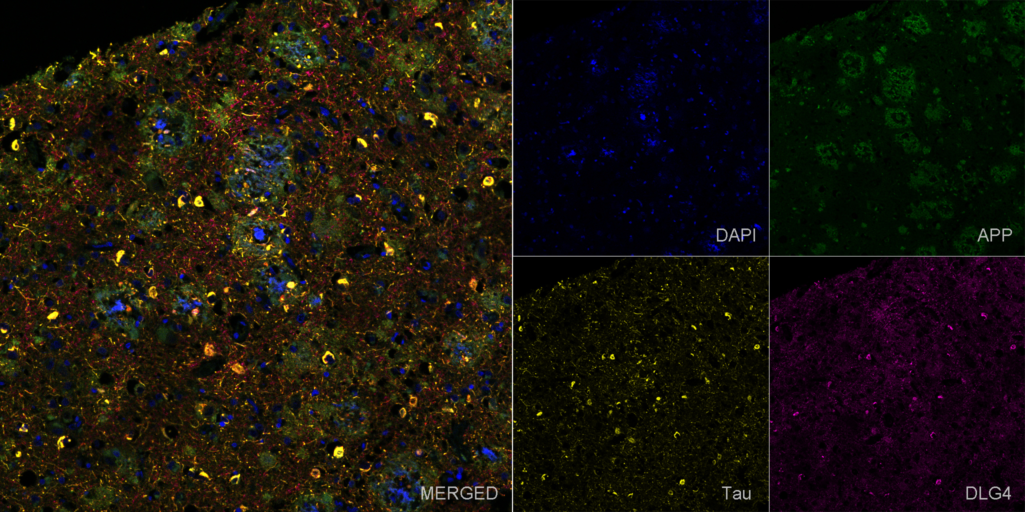 Immunohistochemistry (Formalin/PFA-fixed paraffin-embedded sections) - Anti-beta Amyloid 1-42 antibody [mOC64] - BSA and Azide free (AB271968)