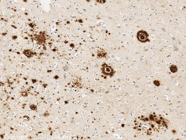 Immunohistochemistry (Formalin/PFA-fixed paraffin-embedded sections) - Anti-beta Amyloid 1-42 antibody [mOC98] - BSA and Azide free (AB240360)
