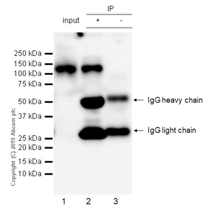 Anti-beta Amyloid antibody [2E9] KO Tested (ab252816) | Abcam