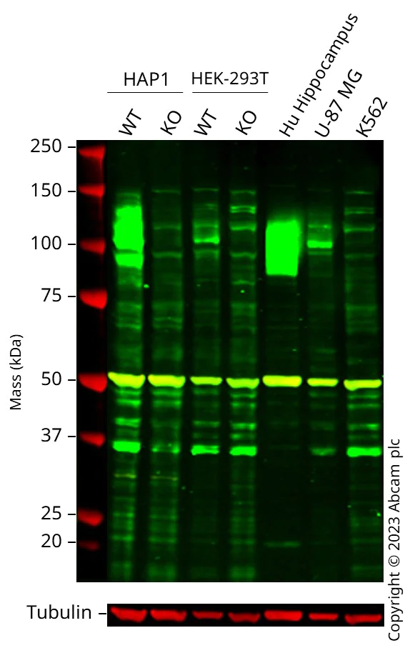 Western blot - Anti-beta Amyloid antibody [2E9] (AB252816)