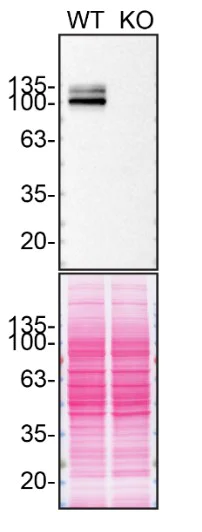 Western blot - Anti-beta Amyloid antibody [2E9] (AB252816)