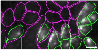 Immunocytochemistry/ Immunofluorescence - Anti-beta Amyloid antibody [2E9] - BSA and Azide free (AB255772), expandable thumbnail