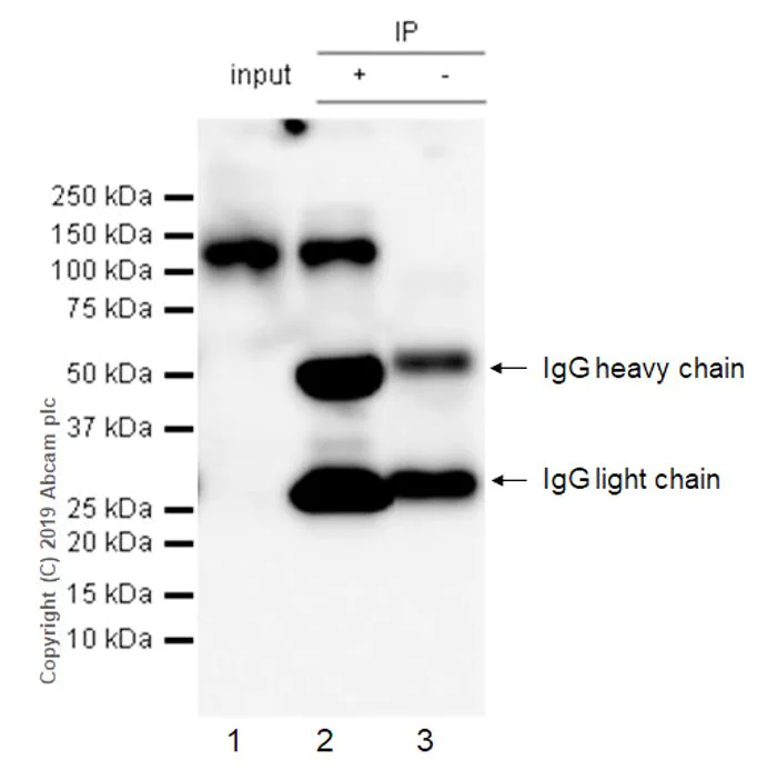 Immunoprecipitation - Anti-beta Amyloid antibody [2E9] - BSA and Azide free (AB255772)