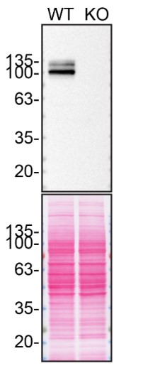 Western blot - Anti-beta Amyloid antibody [2E9] - BSA and Azide free (AB255772), expandable thumbnail
