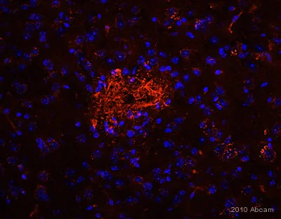 Immunohistochemistry (Frozen sections) - Anti-beta Amyloid antibody [DE2B4] (AB11132)