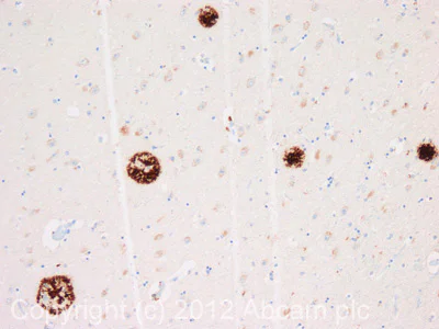 Immunohistochemistry (Formalin/PFA-fixed paraffin-embedded sections) - Anti-beta Amyloid antibody [MOAB-2] (AB126649)