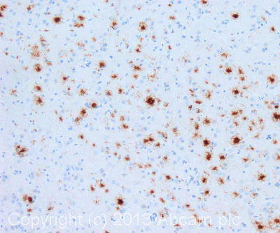 Immunohistochemistry (Formalin/PFA-fixed paraffin-embedded sections) - Anti-beta Amyloid antibody [MOAB-2] (AB126649)