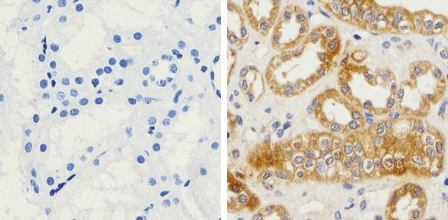 Immunohistochemistry paraffin embedded sections - Anti-beta Amyloid antibody [RP23040033] (AB308108), expandable thumbnail