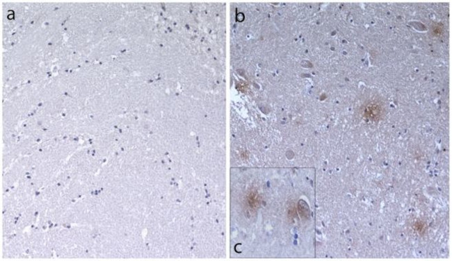 Immunohistochemistry paraffin embedded sections - Anti-beta Amyloid antibody [RP23040033] (AB308108), expandable thumbnail