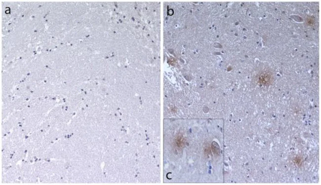 Immunohistochemistry paraffin embedded sections - Anti-beta Amyloid antibody [RP23040033] (AB308108)