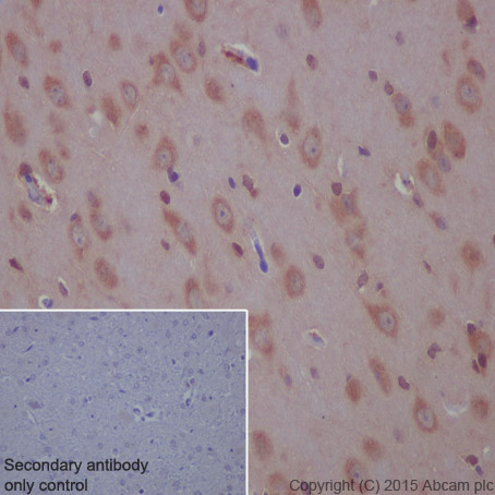 Immunohistochemistry (Formalin/PFA-fixed paraffin-embedded sections) - Anti-beta Arrestin 1 antibody [E274] (AB32099)