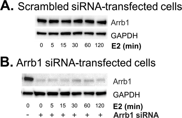 Anti-beta Arrestin 1 antibody [E274]