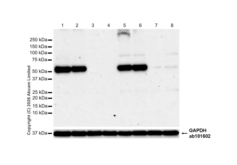 Western blot - Anti-beta Arrestin 1 antibody [E274] (AB32099)