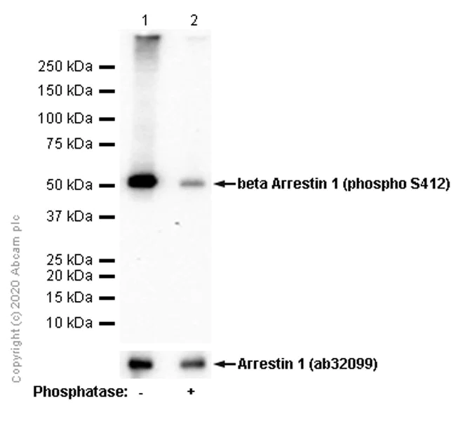 Western blot - Anti-beta Arrestin 1 (phospho S412) antibody [E109] - BSA and Azide free (AB247229)