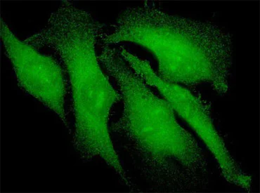 Immunocytochemistry/ Immunofluorescence - Anti-Beta Arrestin 2 antibody [3G1] (AB54790)