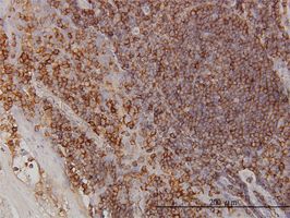 Immunohistochemistry (Formalin/PFA-fixed paraffin-embedded sections) - Anti-Beta Arrestin 2 antibody [3G1] (AB54790)