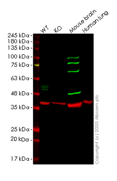 Anti-Beta Arrestin 2 antibody [3G1]
