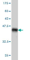 Western blot - Anti-Beta Arrestin 2 antibody [3G1] (AB54790)