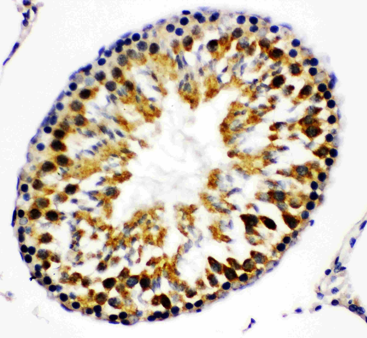 Immunohistochemistry (Formalin/PFA-fixed paraffin-embedded sections) - Anti-Beta Arrestin 2 antibody (AB151774), expandable thumbnail