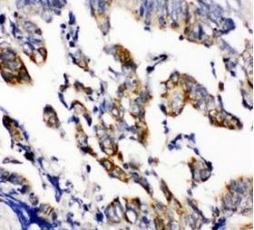 Immunohistochemistry (Formalin/PFA-fixed paraffin-embedded sections) - Anti-Beta Arrestin 2 antibody (AB151774), expandable thumbnail