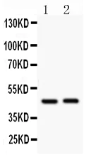 Western blot - Anti-Beta Arrestin 2 antibody (AB151774)